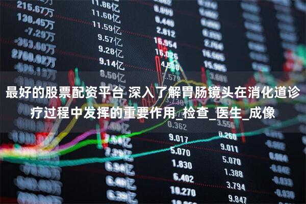 最好的股票配资平台 深入了解胃肠镜头在消化道诊疗过程中发挥的重要作用_检查_医生_成像